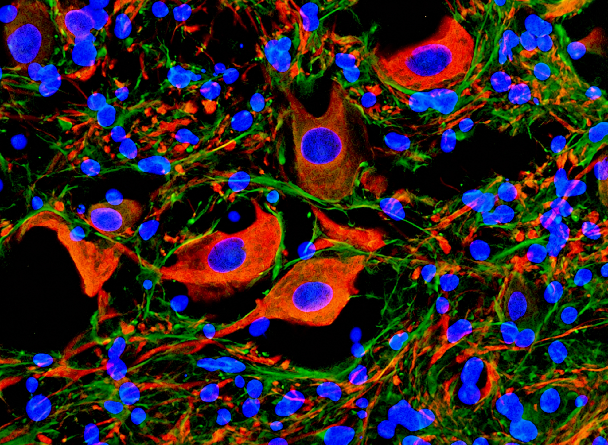 Immunofluorescence of repaired spinal cord tissue: neurofilament-positive axons in red and green with DAPI-stained nuclei in blue